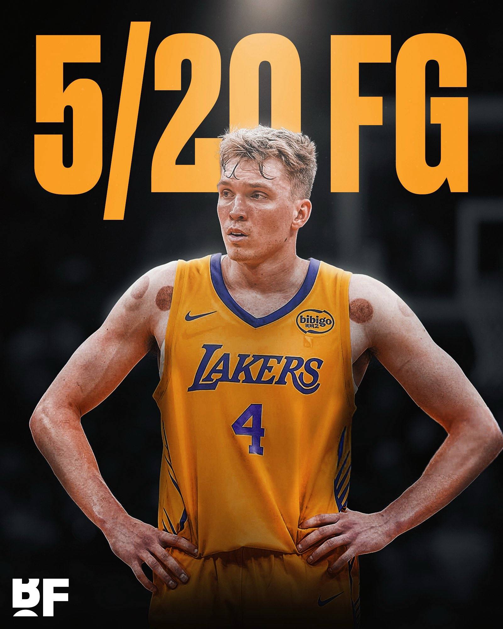 国际比赛日洛杉矶湖人调整名单以备荷甲，篮板制胜环节打磨，信心回归，临场指挥获称赞的简单介绍-九游娱乐APP